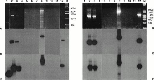 Fig. 5. Amplification of genomic breakpoint on derivative chromosome 2. Genomic DNA was subjected to standard and nested amplification, followed by product separation on a 1% agarose gel. Ethidium bromide staining of standard DNA-PCR products (A) and of the nested DNA-PCR products (D). Lanes 1 through 11, cases 1 through 11; lane 12, t(2;5)+ SU-DHL-1 cell line; lane M, molecular weight marker 1-kb DNA ladder (GIBCO-BRL). The gels were transferred to a nylon membrane and hybridized either with the ALK-2P (radioautographies B and E) or the NPM-2P (radioautographies C and F). The sizes are indicated in bases.