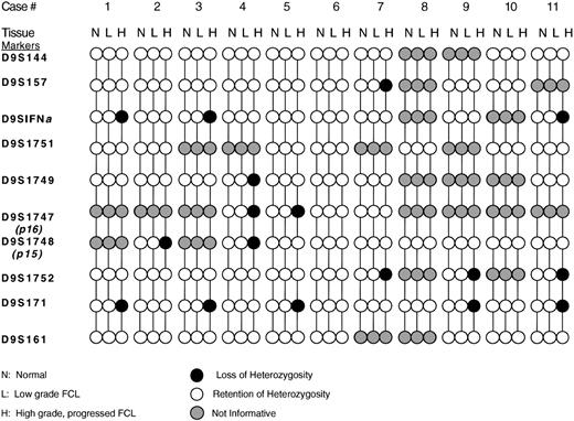 Fig. 2. Deletion map of chromosome 9p21. Cases no. 1, 3, 5, 7, and 11 demonstrate homozygous deletion of the region containing the p16 and p15 genes in the progressed DLCL, but not in the corresponding prior LGFCL or normal patient tissue (see text for complete explanation), whereas cases no. 2, 4, and 9 show hemizygous deletion involving these regions. Cases no. 6, 8, and 10 show no evidence of LOH.