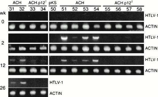 Fig. 5. Detection of HTLV-1 proviral sequences in rabbits inoculated with transfected PBMC. Genomic DNA from PBMC of rabbits inoculated with ACH-(R51-54 and 31-32), ACH.p12- (R55-58 and 33-34), or pKS (vector control)- (R50) transfectants was amplified by PCR using primers specific for HTLV-1 pX (938 bp) or β-actin (415 bp). Sensitivity of the PCR was estimated to be 1 proviral genome per 5,000 cells.