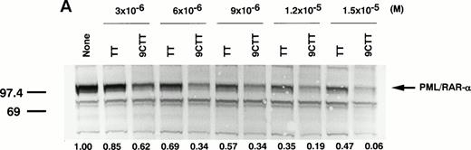 Fig. 5. Expression of PML/RAR-α protein inpml/RAR-α–introduced COS-7 cells (A) and NB4 cells (B) that had been treated with TT or 9CTT. (A) COS-7 cells were transfected with a pml/RAR-α expression vector, pCMX-PML-RAR-α, by lipofection and treated with various concentrations of TT or 9CTT for 2 days. Total cellular protein from 105 cells was separated on a 10% sodium dodecyl sulfate-polyacrylamide gel and blotted onto an Immobilon membrane. The PML/RAR-α protein was detected with a rabbit polyclonal antibody to RAR-α and visualized with a biotin-avidin-alkaline phosphatase system. The amount of the fusion protein was quantified with a densitometer and compared with that in the untreated cells. Two additional experiments showed similar results. (B) NB4 cells (2 × 105/mL) were treated with TT or 9CTT for 4 days and the crude nuclear extracts (20 μg) were separated on a gel. The fusion protein was detected with an anti-PML antibody.