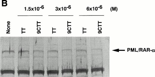 Fig. 5. Expression of PML/RAR-α protein inpml/RAR-α–introduced COS-7 cells (A) and NB4 cells (B) that had been treated with TT or 9CTT. (A) COS-7 cells were transfected with a pml/RAR-α expression vector, pCMX-PML-RAR-α, by lipofection and treated with various concentrations of TT or 9CTT for 2 days. Total cellular protein from 105 cells was separated on a 10% sodium dodecyl sulfate-polyacrylamide gel and blotted onto an Immobilon membrane. The PML/RAR-α protein was detected with a rabbit polyclonal antibody to RAR-α and visualized with a biotin-avidin-alkaline phosphatase system. The amount of the fusion protein was quantified with a densitometer and compared with that in the untreated cells. Two additional experiments showed similar results. (B) NB4 cells (2 × 105/mL) were treated with TT or 9CTT for 4 days and the crude nuclear extracts (20 μg) were separated on a gel. The fusion protein was detected with an anti-PML antibody.