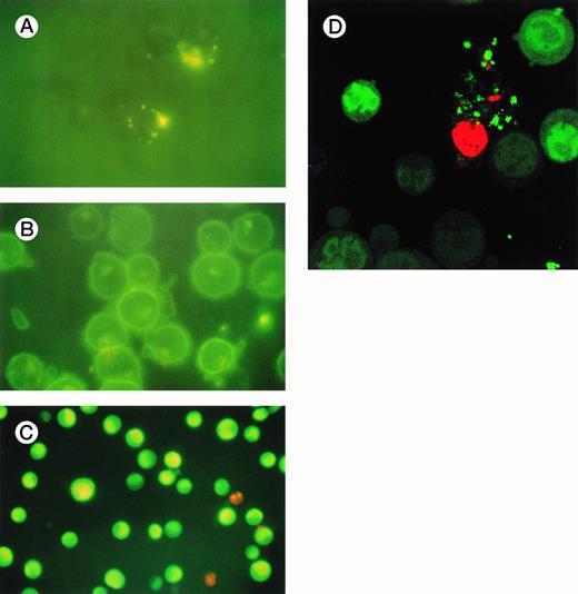 Fig. 6. Fluorescence microscopic appearances of KYO1 cells 6 hours after exposure to (A) 100 μmol/L unconjugated ODN without SL-O permeabilization; (B) 20 μmol/L cholesterol conjugated ODN without SL-O permeabilization; (C) 20 μmol/L unconjugated ODN after initial cellular permeabilization with SL-O; and (D) 20 μmol/L unconjugated ODN after electroporation.