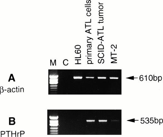 Fig. 1. Expression of PTHrP mRNA by RT-PCR analysis in the original leukemic cells and tumor cells from ATL mice. To detect β-actin and PTHrP mRNAs, PCR was performed for 25 and 38 cycles, respectively. C, negative control (RT reaction without RNA). ◊X174 DNA digested with HinfI was used as a molecular weight marker (M).
