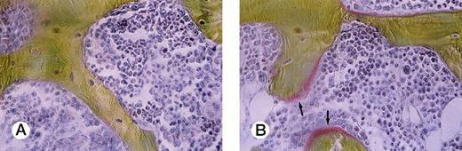 Fig. 2. Villanueva Goldner staining of representative sections of lumbar vertebra from a control mouse and an ATL mouse. Arrows indicate osteoid surface, which is markedly decreased in an ATL mouse (A) compared with a control SCID mouse (B).