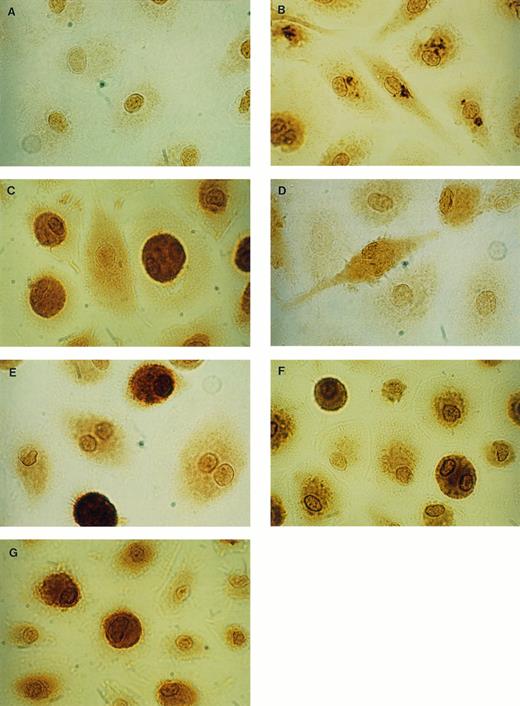Fig. 1. Immunocytochemical staining of uninfected MAC. By using IgG1 antibodies for negative control (isotype control), only an unspecific staining of the area of the nucleus of the cells was seen (A). With specific anti–IL-8 antibodies, intracellular IL-8 could be detected after 4 hours stimulation with LPS as granulated staining (B) and after 24 hours LPS as diffuse staining (C). After 4 hours stimulation with LPS, low amounts of IL-1β could be detected (D) and after 24 hours LPS, a strong specific staining was observed (E). Intracellular G-CSF could be detected in unstimulated cultures (F), as well as in LPS-stimulated cultures (G) (× 1,500).
