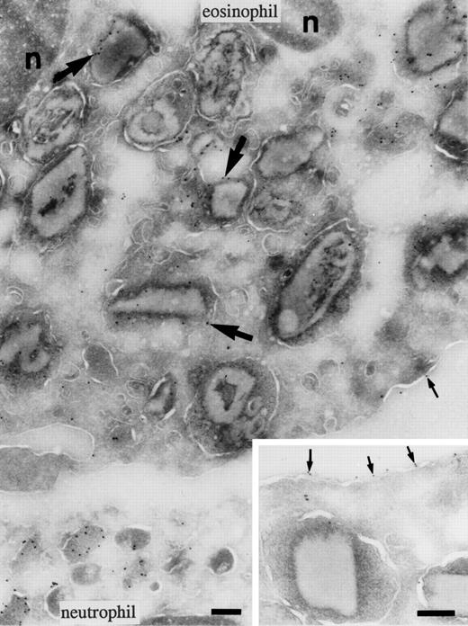 Fig. 2. Localization of BPI in eosinophils. Cryosections of eosinophils labeled to detect BPI. Labeling of the core-containing specific granules of eosinophils was heterogeneous. The top of the micrograph shows an eosinophil with labeled granules (large arrows); however, the labeling was less intense than in the neutrophil at the bottom. Some labeling (small arrows) was also observed on the surface membrane of the eosinophil (insert). The nucleus (n) was unlabeled. Bars = 200 nm.