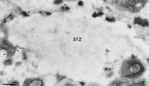 Fig. 4. Localization of BPI in eosinophils after coincubation with STZ. Cells were prewarmed for 10 minutes at 37°C and activated with IL-5 at 0.1 nmol/l for 20 minutes before the addition of STZ and coincubation for 10 minutes. Ultrathin cryosections were incubated with anti-BPI and visualized by secondary gold-conjugated antibody. Area of an eosinophil showing a phagosome with a STZ containing BPI. Granules are seen fusing with the phagosome (arrowheads), whereas some intact granules (g) are seen close to the membrane of the phagosome. Bar = 400 nm.