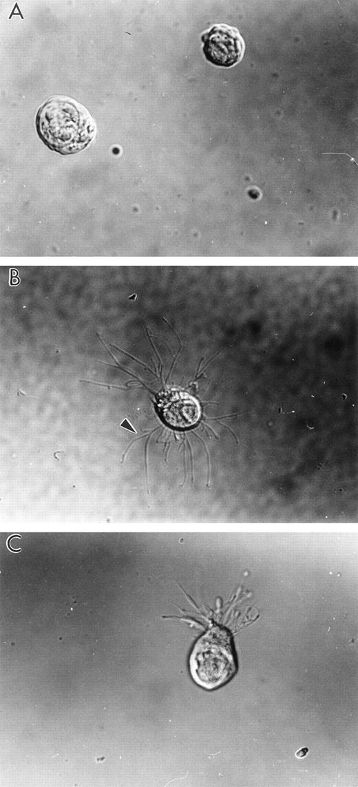 Fig. 2. Human LSP1 expression in Sf9 cells causes formation of hairlike, filamentous projections. Shown are DIC photomicrophs on Sf9 cells infected for 48 hours with either (A) recombinant CAT baculovirus or (B and C) recombinant huLSP1 baculovirus which overexpress the polyhisCAT and polyhis-huLSP1 in Sf9. Note branches (arrowhead) of hairlike projections.