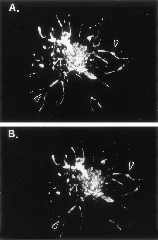 Fig. 3. F-actin and human LSP1 colocalize in hairlike projections of Sf9 cells. Shown are fluorescence photomicrographs of 48-hour huLSP1 baculovirus infected Sf9 cells double-labeled with both (A) anti-LSP1 and fluorescein-tagged second antibody and (B) rhodamine phalloidin for F-actin. Note both labels colocalize in the cells (arrowhead) and in hairs.