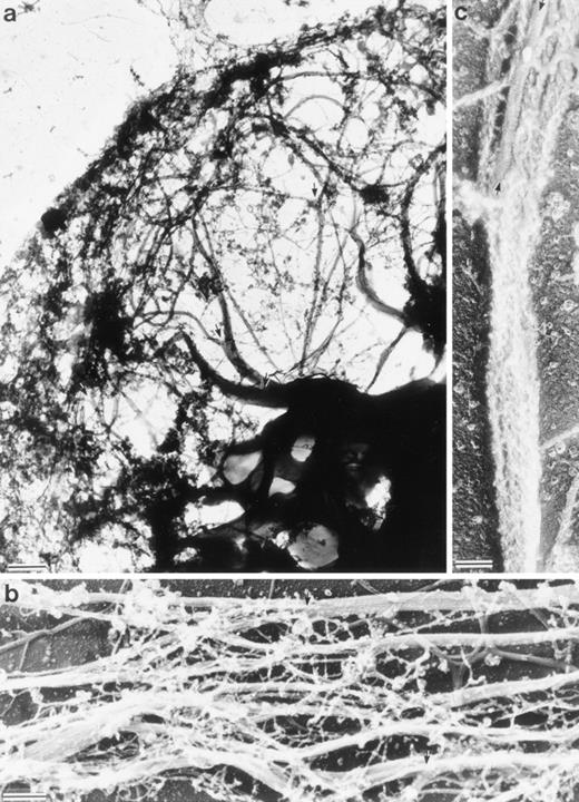 Fig. 4. Structure of the Sf9 cytoskeletal bundles and hairs projected from the Sf9 cells expressing LSP1. (a) The low magnification micrograph shows a portion from a representative Sf9 cytoskeleton that had produced hairlike projections. Bundles of filaments are found through out the cytoplasm. Large bundles originate in the perinuclear region and, at many points, bundles intersect and/or branch (arrows). Sf9 cells were infected for 48 hours with recombinant huLSP1 baculovirus, attached to coverslips by centrifugation at 280g, Triton X-100 extracted, fixed, rapidly frozen, freeze-dried, and rotary coated with 1.4 nm of tantalum, tungsten, and 2.5 nm of carbon. The bar is 1 μm. (b) Higher magnification of filament bundles. Individual filaments composing the bundles have 10-nm diameters. Some bundle branch points are indicated with arrows. (c) Demonstration that the 10-nm filaments are actin using myosin S1 to decorate them. Bundles are seen to be composed of actin filaments with mixed polarity. Bundles also can contain structures which fail to bind myosin S1 (arrows). The bars in (b) and (c) are 100 nm.