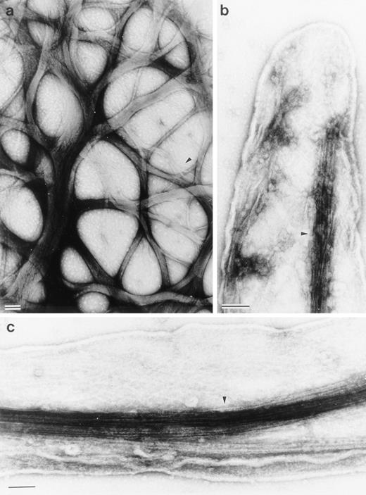 Fig. 5. Structure of interlacing bundles of F-actin in Sf9 cells and of isolated hairlike projections. (a) Structure of cytoplasmic bundles in Sf9 cell after staining with 2% uranyl acetate. This representative micrograph shows the complexity of bundle interdigitation. Ends of bundles can be observed to splay out into their individual component filaments at many points (arrowheads). (b and c) Structure of hairlike projections. Hairs were separated from intact cells by mechanical agitation and centrifugation. Hairs are bound by membrane and are cored by organized filament bundles (arrowhead). Bundles abruptly end near the tips of projections (b). The bars are 100 nm.