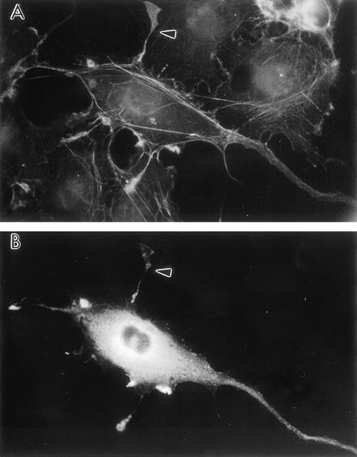 Fig. 6. Transient human LSP1 expression in CV1-COS cells. Shown are fluorescence photomicrographs of CV1-COS cells transiently transfected with pCMD8-huLSP1 expressing huLSP1 and double-labeled with anti-LSP1 with fluorescein tagged second antibody and rhodamine phalloidin for F-actin. Photomicrographs are (A) the rhodamine phalloidin image and (B) the huLSP1 image of the same cell. Note thin projections with F-actin and huLSP1 (arrowhead).