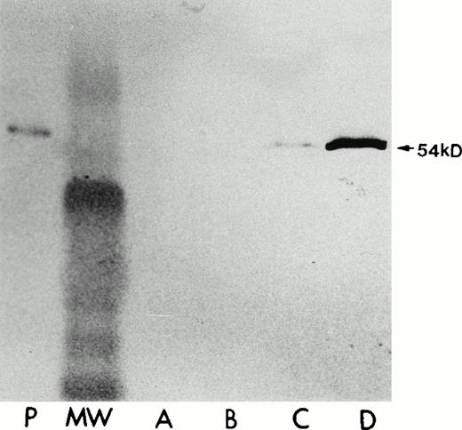 Fig. 7. Human LSP1 expression in the stably transfected A7 melanoma cells, A7ML1, in the absence/presence of Zn2+. Shown are immunoblots with anti-LSP1 of 50 μg total cellular protein from (P) PMNs, (A) parent A7 melanoma cells alone + 100 μmol/L Zn2+ for 6 hours, (B) the A7 melanoma line stably transfected with pMEP vector alone + 100 μmol/L Zn2+for 6 hours; (C and D) the A7ML1 cell line stably transfected with pMEP-huLSP1 in the absence (C) and presence (D) of 100 μmol/L Zn2+ for 6 hours. MW, molecular weight marker. The immunoblot was developed colorimetrically.