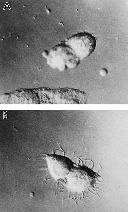 Fig. 8. Increased level of human LSP1 causes formation of hairlike projections on A7 melanoma cell line, A7ML1. Shown are DIC photomicrographs of the A7 melanoma cell line, A7ML1, stably transfected with pMEP-huLSP1 and exposed 6 hours to (A) serum-free culture medium without Zn2+ or (B) serum-free culture medium plus 100 μmol/L Zn2+ for 6 hours. Exposure of A7 melanoma cells stably transfected with pMEP alone to Zn2+does not cause hairlike projection formation (not shown).
