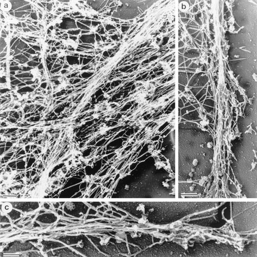 Fig. 9. Organization of cytoskeletal actin in A7ML1 cell line expressing LSP1. Electron micrographs show Zn2+ induction of LSP1 expression in the melanoma A7 cell line, A7ML1, results in the formation of cytoplasmic filament bundles and hairlike projections similar to those in LSP1 expressing Sf9 cells. (a) Filaments in the cytoskeletal bundles are not as tightly packed as those in Sf9 cells but have a similar intersecting morphology. (b and c) The structure of cytoplasmic actin within two projections. The bars are 100 nm.