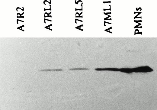Fig. 10. Expression of LSP1 in stably transfected, constituitively expressing A7 melanoma lines used to analyze motility. Shown is an anti-LSP1 immunoblot developed by chemiluminescence of equal protein loads of (P) PMNs, the stably transfected, constituitively expressing A7ML1, A7RL5, A7RL2 cell lines and a control line, A7R2, stably transfected with pREP vector alone.