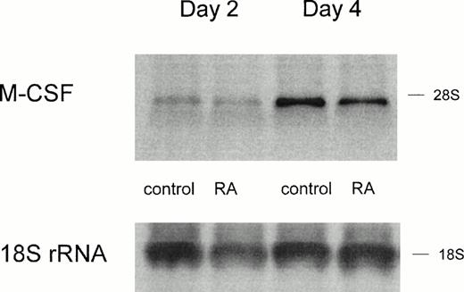 Fig. 3. M-CSF expression on mRNA level is only slightly altered by RA treatment. RNA was isolated from MO cultured for 2 days or 4 days on teflon foils with or without 10−7 mol/L RA. Northern analysis was performed according to the Materials and Methods. Hybridization with an 18S rRNA oligonucleotide is shown as a loading control.