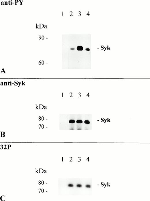 Fig. 2. Syk is a major target of FcαR-induced PTK activity. THP-1 cells were activated at 37°C for 5 minutes by the addition of 5 μg/mL Mo2 (lanes 1 and 2), My43 cell culture supernatant 1:2 (lane 3), and RPMI 1640 cell culture medium only (lane 4). Lysates from 1.5 × 107 cells were immunoprecipitated with a rabbit polyclonal anti-Syk antibody (lanes 2 through 4) or control rabbit polyclonal IgG (lane 1). Two thirds of each immunoprecipitate were separated by 8% to 12% SDS-PAGE, transferred to NC sheets, and immunoblotted with an antiphosphotyrosine antibody (A). The immunoblot was afterwards stripped and reprobed with Syk-specific antibody (B). One third of each immunoprecipitate was used for in vitro kinase assay, as described in the Materials and Methods; separated by 8% to 12% SDS-PAGE; and autophosphorylated Syk kinase was detected on dried gels using autoradiography (C).