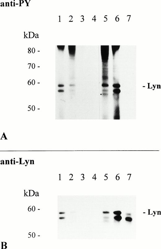 Fig. 5. Association of Lyn with FcαR is sensitive to treatment with PP1. THP-1 cells (1 × 107/sample) were incubated at 37°C for 30 minutes in RPMI 1640 cell culture medium only (lanes 1, 4, and 5) and cell culture medium containing 10 μmol/L of PP1 (lanes 2 and 6) or 100 μmol/L of PP1 (lanes 3 and 7). Subsequently, cells were activated at 37°C for 5 minutes with 2.5 mg of NC particles adsorbed with huIgA (lanes 1 through 3), huIgG (lanes 5 through 7), or BSA only (lane 4). Immunoprecipitation, separation of precipitated proteins by 8% to 12% SDS-PAGE, and antiphosphotyrosine immunoblot analysis of isolated proteins were performed as described in Materials and Methods (A). Reprobing of the same immunoblot with Lyn-specific antibody (B).
