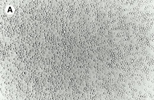 Fig. 1. Morphology of isolated cells in culture. (A) Purified adherent monocytes used for initiation of dendritic cells. (B) After 48 hours in culture with GM-CSF and IL-4, monocytes clustered into aggregates typical of dendritic cell precursors.