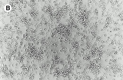 Fig. 1. Morphology of isolated cells in culture. (A) Purified adherent monocytes used for initiation of dendritic cells. (B) After 48 hours in culture with GM-CSF and IL-4, monocytes clustered into aggregates typical of dendritic cell precursors.