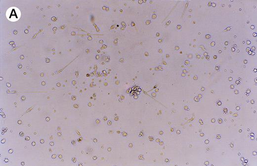 Fig. 5. Expression of GFP in cultured dendritic cells. (A) Transmitted light micrograph of dendritic cells 3 days after infection with AdRSVGFP in the presence of cationic liposomes. (B) Same field as in (A) under fluorescence detection using a fluorescein filter set. GFP was expressed in adherent, nonadherent, and loosely attached cells.