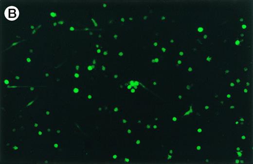 Fig. 5. Expression of GFP in cultured dendritic cells. (A) Transmitted light micrograph of dendritic cells 3 days after infection with AdRSVGFP in the presence of cationic liposomes. (B) Same field as in (A) under fluorescence detection using a fluorescein filter set. GFP was expressed in adherent, nonadherent, and loosely attached cells.