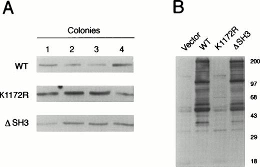 Fig. 1. BCR/ABL expression and protein tyrosine phosphorylation in individual 32D clone transfectants expressing wild-type or mutant BCR/ABL protein. (A) Expression of wild-type (WT), kinase-deficient mutant (K1172R), or ▵SH3 BCR/ABL proteins was examined in four 32Dcl3 transfectants by Western blotting with anti-ABL MoAb. (B) Phosphorylation of cellular proteins was analyzed after SDS-PAGE of cell lysates from the same clones as in (A) using anti-P.Tyr MoAb 4G10. Results are representative of three independent experiments.