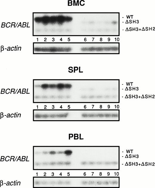 Fig. 5. Detection of BCR/ABL transcripts in hematopoietic organs of SCID mice inoculated with BMC infected with wild-type or ▵SH3 BCR/ABL. Preirradiated C57BL/6-SCID-SzJ mice were injected with 106 BMC infected with the wild-type (lanes 1 through 5) or ▵SH3 BCR/ABL (lanes 6 through 10) retrovirus. After 4 weeks, mononuclear cells from bone marrow (BMC), spleen (SPL), and peripheral blood (PBL) were harvested and BCR/ABL transcripts were detected by RT-PCR. To control the efficiency of RT-PCR in each sample, 102 32Dcl3 transfectants expressing the ▵SH3+▵SH2 BCR/ABL mutant were added to each sample before RNA extraction. As an additional control of the RNA preparation, β-actin transcripts were also amplified from each sample.