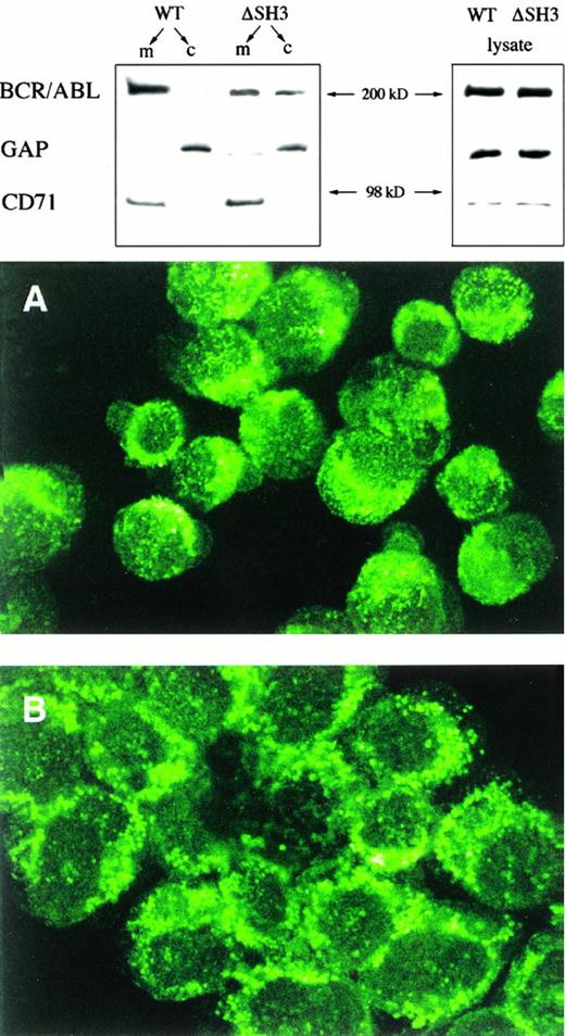 Fig. 8. Intracellular localization of BCR/ABL proteins. (Top panel) Membrane (m) and cytosolic (c) BCR/ABL, p120 GAP, and transferrin receptor (CD71) were analyzed in BCR/ABL (wild-type and ▵SH3) transfectants by SDS-PAGE followed by Western blotting with anti-ABL, anti-GAP, and anti-CD71 MoAbs. As a control, the same proteins were also detected in total cell lysates. Results are representative of three different experiments. (Bottom panel) 32Dcl3 cells expressing wild-type (A) or ▵SH3 mutant (B) BCR/ABL were incubated with anti-ABL followed by FITC-conjugated goat antirabbit antibody and examined by confocal microscopy. Results are representative for three individual clones from each group (original magnification × 800).
