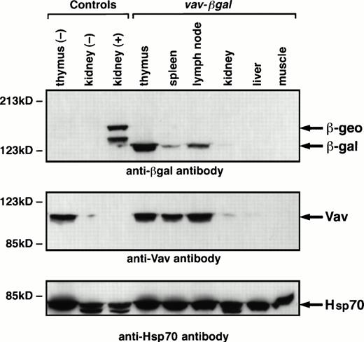 Fig. 6. Immunoblots showing β-gal and Vav proteins in tissue extracts. The tissue extracts derived from HS21/5 vav-βgalmice, nontransgenic (negative control) mice, or Rosa26 (positive control) animals. The blots were probed with monoclonal antibodies to p95Vav or β-gal and, as a loading control, antibody to Hsp70, and bands were shown with a sheep antimouse Ig reagent. ThelacZ-neo gene fusion in Rosa26 animals consistently yields a 146-kD polypeptide (β-geo) and a smaller product (125 kD), perhaps related to the two transcripts observed in these mice.26