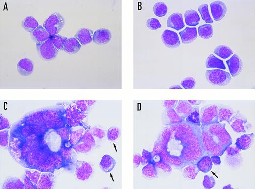 Fig. 2. Morphological changes induced by electroporation of the GATA-1 expression vector. (A) M1 clone transfected with the control vector (M1/pMG2), (B) M1GATA-Y1 clone, (C) M1GATA-Y22 clone, and (D) M1GATA-Y25 clone. Arrows indicate the erythroblasts.
