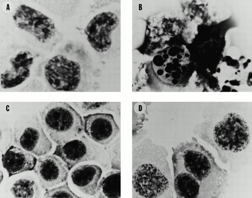 Fig. 2. Morphology of SUDHL4 and PC-3 cells after exposure to flavopiridol. (A) Untreated control SUDHL4s. (B) SUDHL4s after 12 hours exposure to flavopiridol at 1,000 nmol/L. (C) Untreated control PC-3s. (D) PC-3s after 12 hours exposure to flavopiridol at 1,000 nmol/L. Photography was at 1,000 ×, oil immersion microscope, after cytospin preparation as described in Materials and Methods.