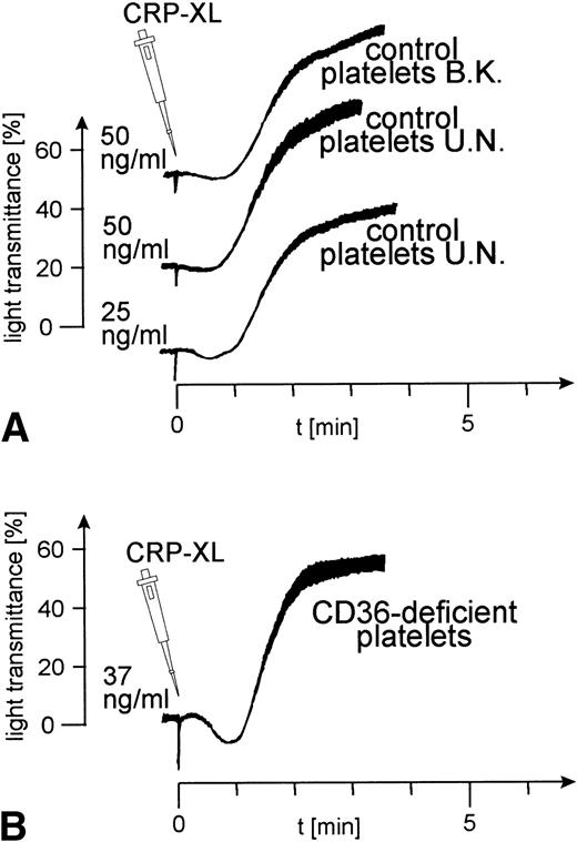 Fig. 1. Normal platelet aggregation induced by CRP-XL in platelet-rich plasma (PRP). (A) Control platelets; (B) CD36-deficient platelets from donor Y.A. The platelet counts were adjusted to 2 × 108/mL. The experiment shown is representative of three similar experiments.