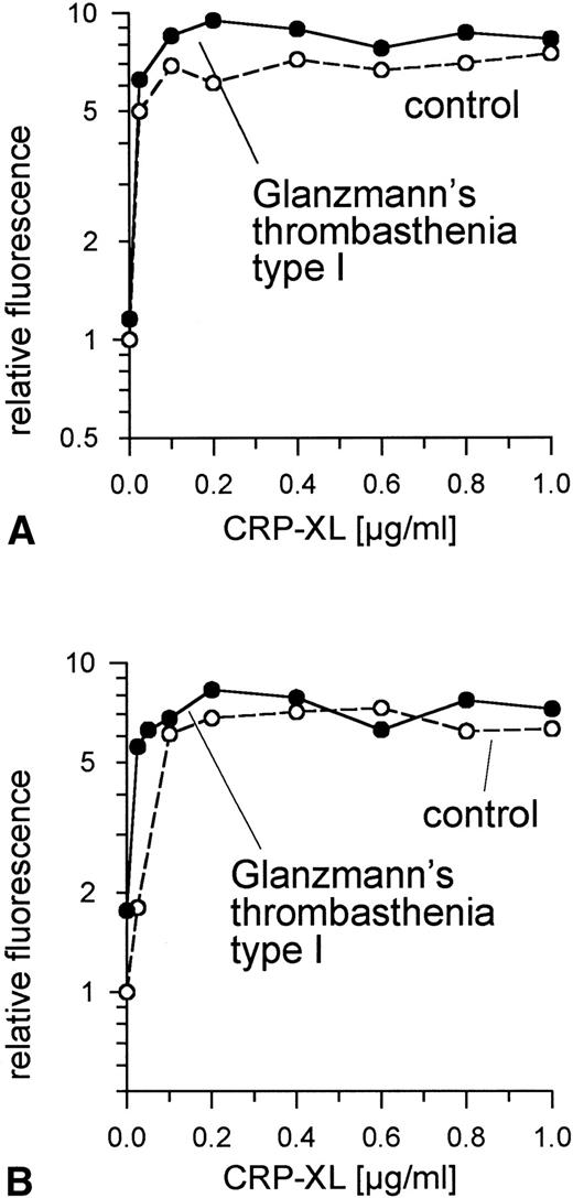 Fig. 3. Normal expression of CD62 (A) and of CD63 (B) on GPIIb/IIIa-deficient platelets and control platelets induced by CRP-XL, measured by flow cytometry after labeling with anti-CD62-FITC or anti-CD63-FITC, respectively. Fluorescence of unstimulated control platelets is defined as 1. Data shown are representative of two similar experiments.