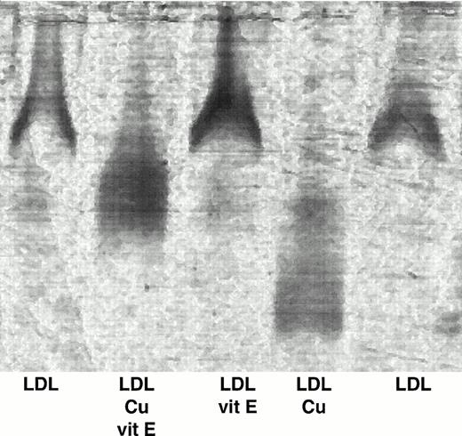 Fig. 2. Effect of vitamin E on the oxidation state of LDL. LDL from 9 subjects was incubated with or without vitamin E before copper oxidation. The samples were subjected to gel electrophoresis and stained with Sudan Black as described previously. This is a representative photograph showing unmodified LDL, LDL preincubated with vitamin E before copper oxidation, LDL incubated with vitamin E, oxidized LDL, and unmodified LDL.