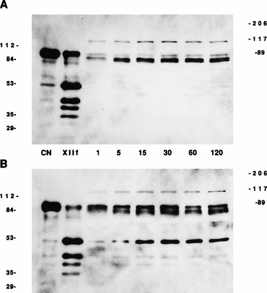Fig. 5. Conversion of HUVEC-bound PK to kallikrein. HUVECs were incubated with buffer (A) or with 20 nmol/L HK (B) for 1 hour at 37°C. Unbound HK was removed and 20 nmol/L biotin-PK was added for 1 to 120 minutes at 37°C. After washing, the cells were solubilized by adding electrophoresis sample buffer containing 2% β-mercaptoethanol. The proteins were boiled and then separated on 10% SDS-PAGE and electroblotted onto nitrocellulose, and biotin-PK was detected by adding streptavidin-horseradish peroxidase. Photographs of ligand blots on nitrocellulose are shown. The numbers on each side of the photographs are molecular mass standards in kilodaltons. The numbers between the photographs show the time of incubation with PK. CN represents soluble biotin-PK starting material and XIIf represents βFXIIa-cleaved biotin-PK analyzed by SDS-PAGE in the absence of cells.