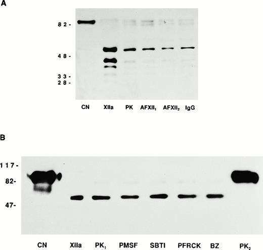 Fig. 6. Endothelial cell prekallikrein activation. (A) CN represents biotin-PK directly added to the SDS-PAGE. XIIa represents factor XIIa-cleaved soluble biotin-PK. PK represents the form of 20 nmol/L biotin-PK bound to HK on HUVECs. In this experiment, HUVECs were incubated with 20 nmol/L HK for 1 hour at 37°C. After washing the cells, 20 nmol/L biotin-PK was added in the absence (PK) or presence of two neutralizing antibodies to FXII (AFXII1 and AFXII2) or normal goat IgG (IgG). The biotin-PK was detected by chemilluminesence. The figure is a photograph of a 10% SDS-PAGE after the proteins were reduced with 5% β-mercaptoethanol and boiling. (B) CN represents biotin-PK directly added to the SDS-PAGE. XIIa represents factor XIIa-cleaved soluble biotin-PK. In this experiment, HUVECs were treated with 20 nmol/L HK for 1 hour at 37°C. After washing the cells, 20 nmol/L biotin-PK was added in the absence (PK1) or presence of PMSF (1 mmol/L), SBTI (2 μg/mL), Pro-Phe-Arg-chloromethylketone (PFRCK; 100 μmol/L), or benzamidine (BZ; 1 mmol/L). PK2 was 40 nmol/L biotin-PK bound to HUVECs in the absence of HK. The biotin-PK was detected by chemilluminesence. The figure is a photograph of a 7% SDS-PAGE after the proteins were reduced with 5% β-mercaptoethanol and boiling.