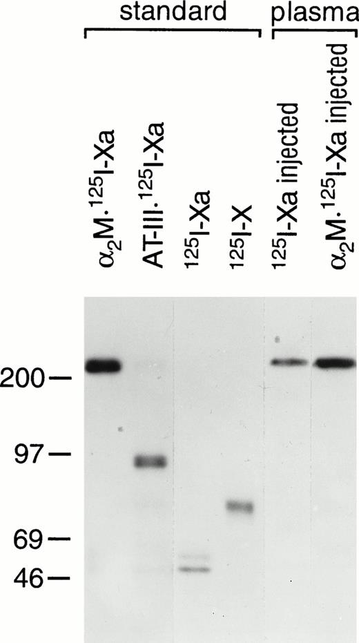 Fig. 3. Plasma species of 125I-Xa and α2M:125I-Xa after injection to mice. As described in the text, plasma samples (3 μL) obtained 30 seconds after the injection of 125I-Xa or α2M:125I-Xa were subjected to 7.5% SDS-PAGE and autoradiography. Standards containing α2M:125I-Xa, AT-III:125I-Xa,125I-Xa, and 125I-X were also analyzed as indicated. Molecular weight markers in kilodaltons are indicated on the left.