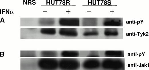 Fig. 5. IFNα-induced Janus kinases activation HUT78 cells. The cells were treated with (+) or without (−) IFNα (10,000 U/mL for 5 minutes) and whole cell extracts were prepared for immunoprecipitation with anti-Tyk2 (Fig 5A) or anti-Jak1 (Fig 5B) antibody. The immunocomplex was then analyzed by Western blot using anti-phosphotyrosine (anti-pY) antibody (upper panels). The same blot was stripped and reprobed with anti-Tyk2 or Jak1 antibody to determine the levels of protein in each lane (lower panels).