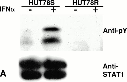 Fig. 6. Phosphorylation of STAT proteins in HUT78 cells. The cells were treated with (+) or without (−) IFNα (10,000 U/mL for 5 minutes) and whole cell extracts were prepared for immunoprecipitation with anti-STAT antibody. The immunocomplex was then analyzed by Western blot using anti-phosphotyrosine (anti-pY) antibody (upper panel). The same blot was stripped and reprobed with anti-STAT antibody to determine the levels of protein in each lane (lower panel). STAT1 immunoprecipitation is shown in Figure 6A, STAT2 in Figure 6B, and STAT3 in Figure 6C. The arrow in Figure 6B indicates the location of STAT2 and activated STAT1 (doublet) was coprecipitated with STAT2 in HUT78S cells only (Fig 6B, upper panel).