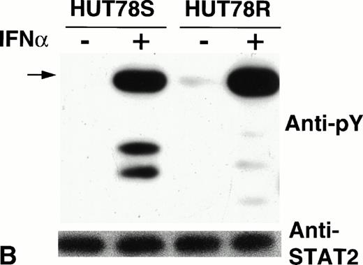 Fig. 6. Phosphorylation of STAT proteins in HUT78 cells. The cells were treated with (+) or without (−) IFNα (10,000 U/mL for 5 minutes) and whole cell extracts were prepared for immunoprecipitation with anti-STAT antibody. The immunocomplex was then analyzed by Western blot using anti-phosphotyrosine (anti-pY) antibody (upper panel). The same blot was stripped and reprobed with anti-STAT antibody to determine the levels of protein in each lane (lower panel). STAT1 immunoprecipitation is shown in Figure 6A, STAT2 in Figure 6B, and STAT3 in Figure 6C. The arrow in Figure 6B indicates the location of STAT2 and activated STAT1 (doublet) was coprecipitated with STAT2 in HUT78S cells only (Fig 6B, upper panel).