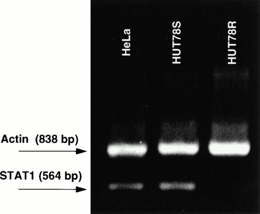 Fig. 7. RT-PCR of STAT1 transcript. Three cell lines were subject to RT-PCR, including HUT78R, HUT78S, and HeLa cells. Primer 1 (5′AAGGTGGCAGGATGTCTCGTG-3′) spans the STAT1 translational initiation site and is complementary to nucleotides 186-207. Primer 2 (5′TGGTCTCGTGTTCTTCTGTTCTG-3′) covers the junction of exon 5 and 6 and is complementary to bases 728-749. The actin mRNA was amplified using primers that are commercially available.