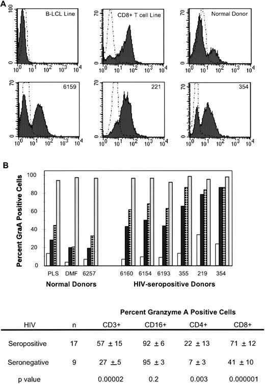 Fig. 3. HIV-infected subjects have an increased frequency of T cells that stain for the cytolytic granule protease grnA. (A) CB9 MoAb stains about 25% of the circulating lymphocytes of a healthy donor but stains the majority of circulating lymphocytes in HIV-infected subjects. (B) An increased number of circulating CD4 (□), CD3 (▪), and CD8 (⊡) T cells in HIV-infected subjects (graphed for representative subjects in order of increasing immunodeficiency) contain the cytolytic effector molecule, grnA. CD16+(▧) NK cells from healthy and HIV-infected donors uniformly contain grnA.