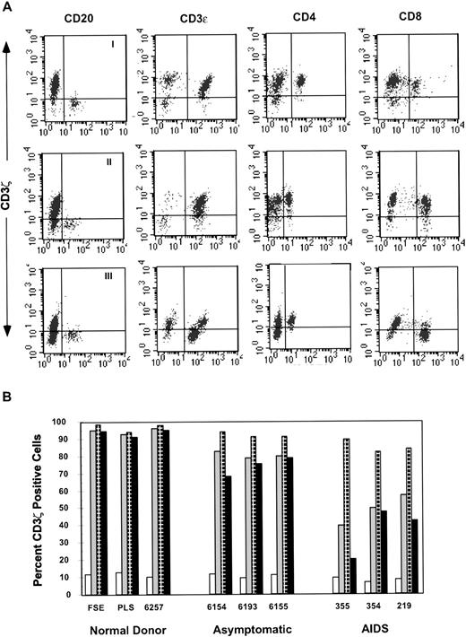 Fig. 5. CD3ζ is downmodulated to a greater extent in CD8 T cells than CD4 T cells. Gated lymphocytes were analyzed for triple staining with antibodies to CD3ζ with CD3 and CD20 or CD4 and CD8. (A) Profile of a healthy donor (I), asymptomatic, slow-progressor subject no. 6156 (II), and AIDS patient no. 355 (III). (B) Representative results from healthy donors, asymptomatic HIV-infected donors and AIDS patients show progressive downmodulation of ζ in CD8 more than CD4 T cells. The percent of CD20 B cells (□), CD3 T cells (▧), CD4 T cells (⊡) and CD8 T cells (▪) that costain with ζ is shown.