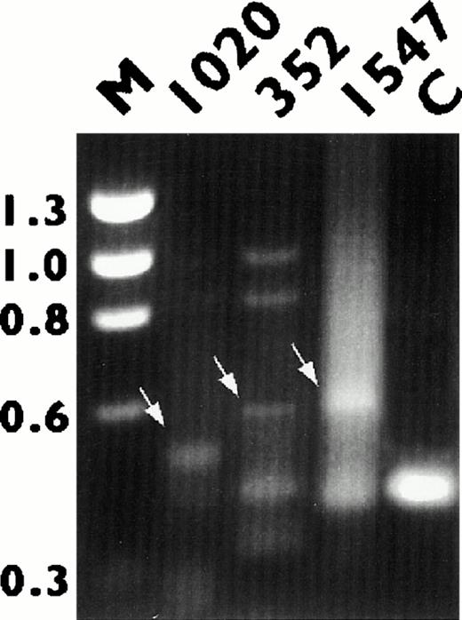 Fig. 2. Detection of BCL6 fusion transcripts by 5′ RACE analysis. RNA derived from tumors 1020, 352, and 1547 were subjected to reverse transcriptase (RT)-PCR amplification as described in the text. Arrows point to bands representing BCL6 chimeric transcripts. RNA from tumor 1562 (C), which showed no BCL6rearrangement by Southern blot analysis, was used as the negative control. The fragment size of the marker ◊X174 RF DNA/HaeIII is indicated.