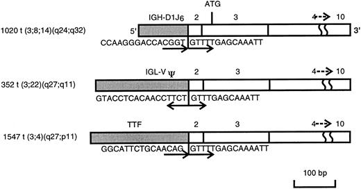 Fig. 3. Schematic representation of BCL6 fusion transcripts obtained by 5′ RACE analysis on cases 1020, 352, and 1547. The BCL6 transcript is shown in the open box, and the transcript fused to the BCL6 is shown in the closed box. Sequence at the junction of each fusion transcript and its orientation are also shown.