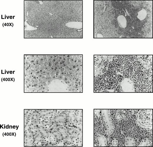 Fig. 1. Histologic examinations of mice 6 weeks after intravenous inoculation of 164T2 (right panel) and 267T2 (left panel) lymphoma cells. Representative sections of kidneys and liver of mice injected with both lymphoma cells are shown. In mice injected with 164T2 cells, massive lymphoma cell infiltration was observed in perivascular stroma of liver sections, whereas in kidneys, massive infiltration was observed in the renal cortex. These results are representative of more than 50 histologic examinations.
