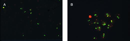 Fig. 1. Analysis of engraftment of human cells in NOD/SCID mice by FISH. (A) Human cells detected by D8Z2 probe show two bright green fluorescent signals in contrast to murine cells with no signal (original magnification × 200). (B) Differential engraftment of normal and leukemic CML cells in NOD/SCID mice detected by dual probes for bcr and abl. Normal cells show two red ablsignals and two green bcr signals. Leukemic cells show a single red and green signal representing normal abl and bcrgenes and the yellow signal representing fusion of abl andbcr genes (original magnification × 1,000).