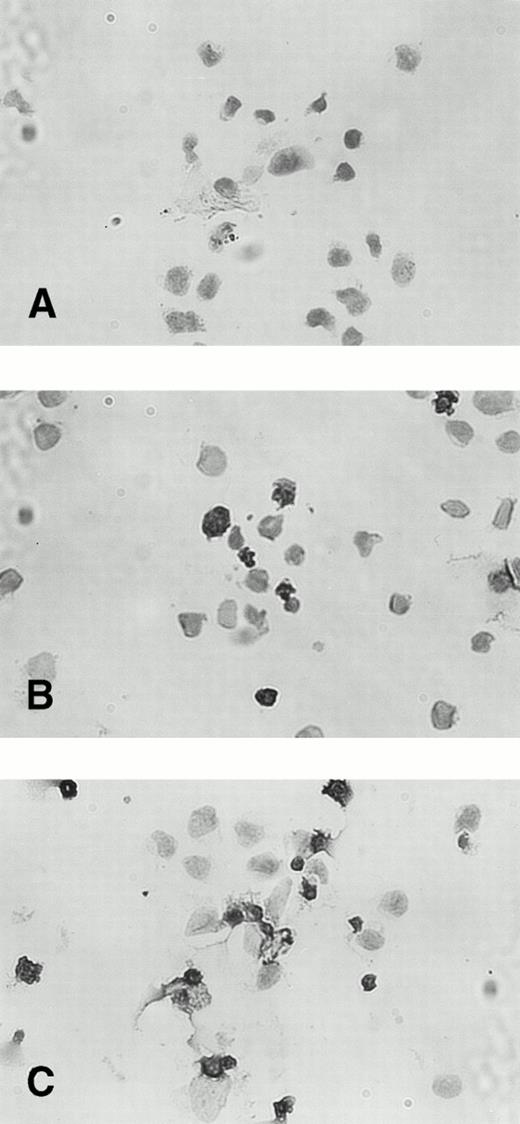 Fig. 6. TUNEL staining of IFN-α–induced apoptosis in KT-1 cells. KT-1 were cultured with IFN-α (1,000 U/mL) for (A) 0 hours, (B) 48 hours, and (C) 96 hours.
